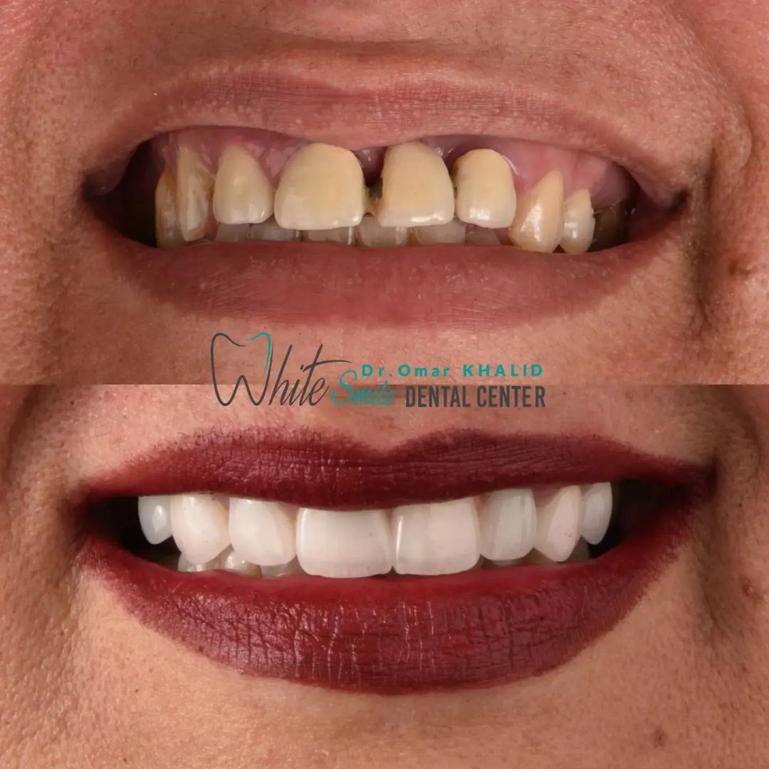 white smile dental center